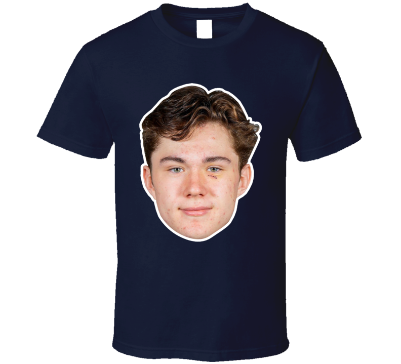 front preview