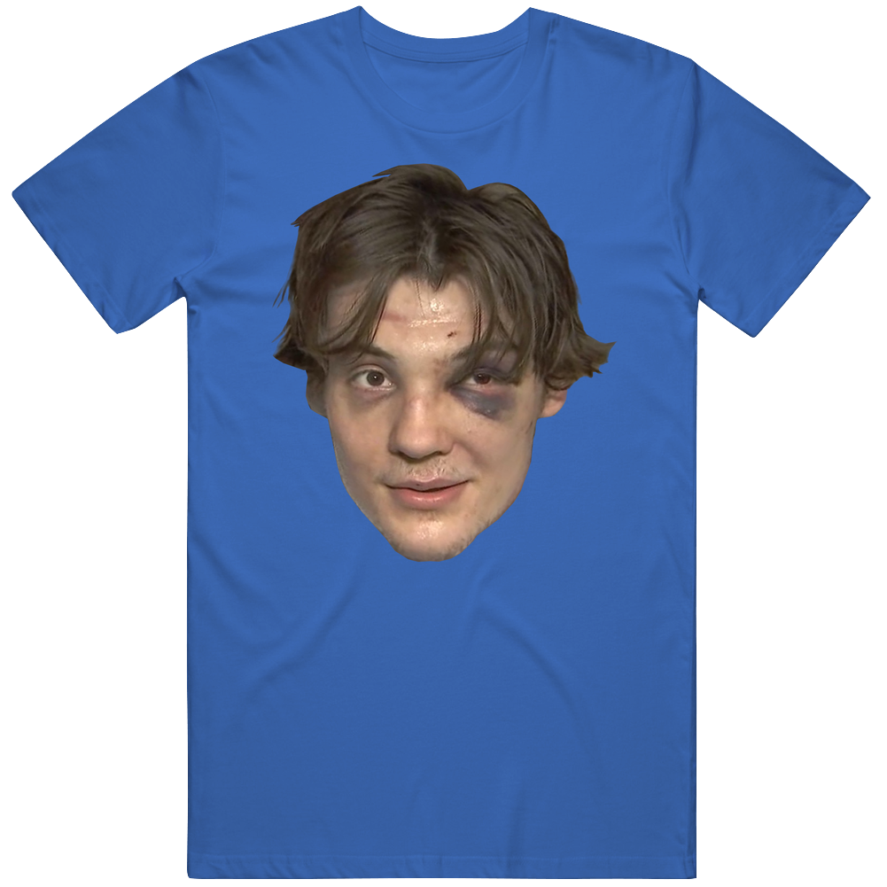 front preview