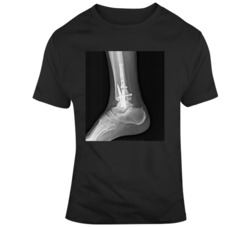 Ponit Guard Ankle Taker Breaker X Ray Basketball Fan  T Shirt