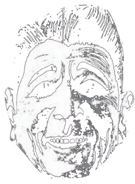 overlay