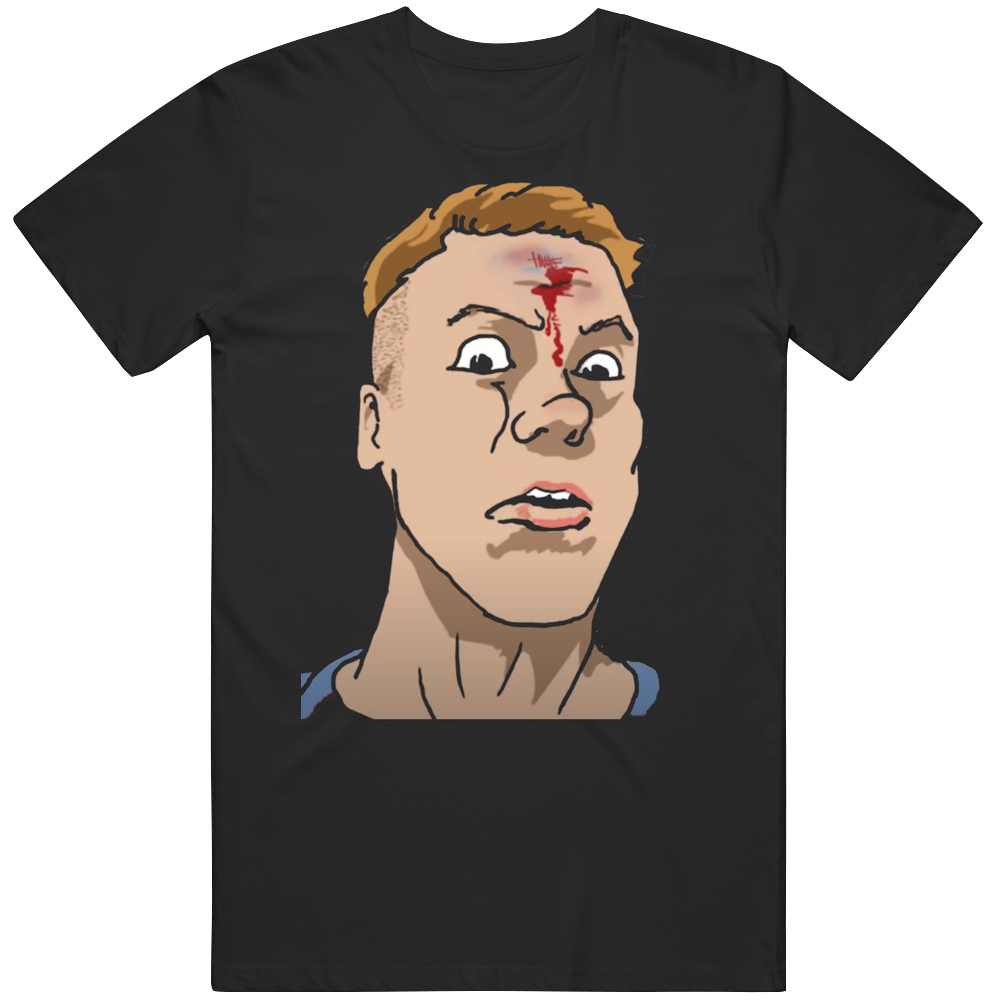 front preview