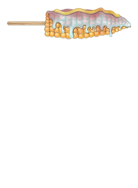 overlay