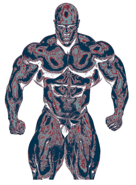 overlay