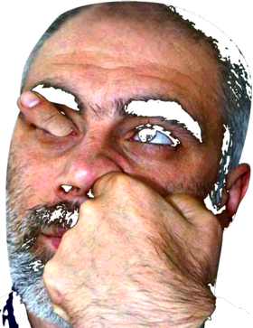 overlay