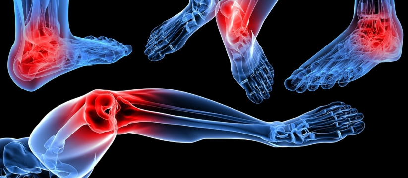 Natural Arthritis Relief