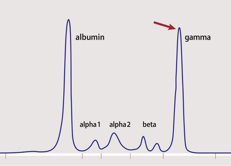 Serum Protein Electrophoresis Anode Cathode at Pattie Dailey blog