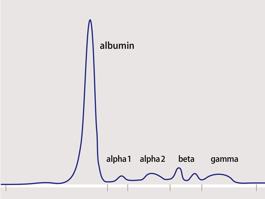 spep alfa 2 m spike meaning