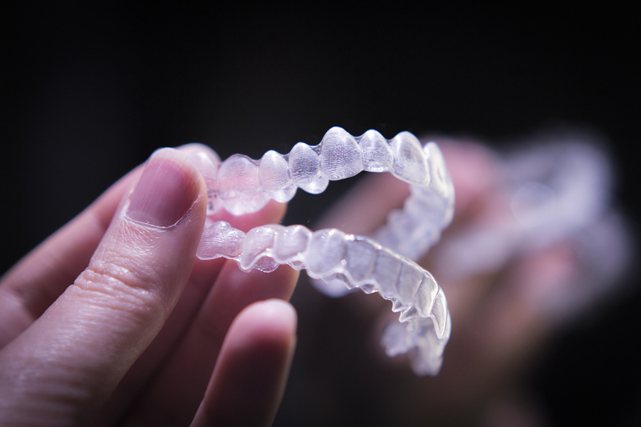 braces and aligners