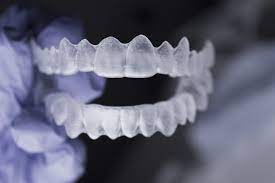3m clear aligners