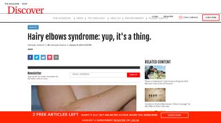 
Hairy elbows syndrome: yup, it's a thing. | Discover Magazine  
