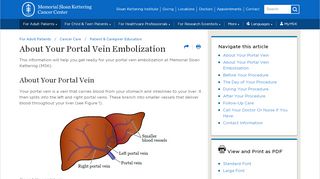 
                            5. About Your Portal Vein Embolization | Memorial Sloan ...