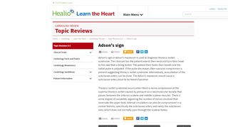 
                            5. Adson's Sign - Definition | LearntheHeart.com