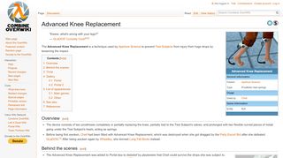 
                            2. Advanced Knee Replacement - Combine OverWiki, the original Half ...