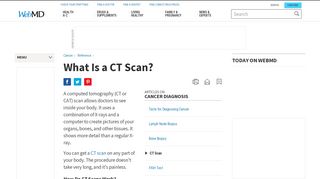 
                            3. CT Scan (CAT Scan): Purpose, Procedure, Risks, Side-Effects, Results