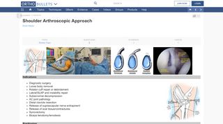 
                            9. Shoulder Arthroscopic Approach - Approaches - Orthobullets