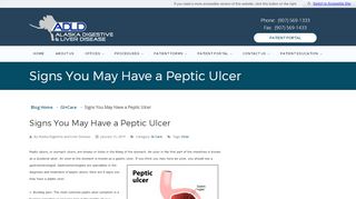 
                            2. Signs You May Have a Peptic Ulcer - Gastroenterologist in Anchorage ...