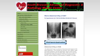 
                            8. What is Abdominal X-Ray or KUB? - Mobile …