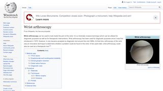 
                            9. Wrist arthroscopy - Wikipedia
