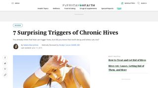 
                            7. 7 Surprising Triggers of Chronic Hives | Everyday Health