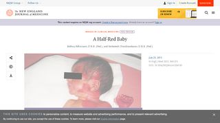 
                            9. A Half-Red Baby | NEJM