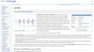 
                            11. AVNRT - ECGpedia