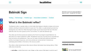 
                            8. Babinski Sign - Healthline