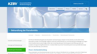 
                            11. Behandlung der Parodontitis - KZBV