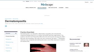 
                            8. Dermatomyositis: Practice Essentials, Background, Pathophysiology
