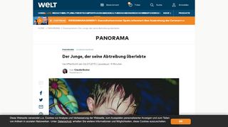 
                            8. Downsyndrom: Der Junge, der seine Abtreibung überlebte - WELT