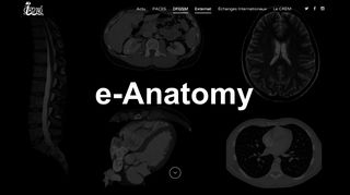 
                            4. e-Anatomy | CREM