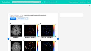 
                            12. FASE image (d), calculated FASE images: “O2 minus Pre-O2” (e ...