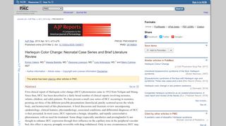 
                            2. Harlequin Color Change: Neonatal Case Series and Brief Literature ...