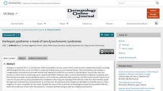 
                            6. Harlequin syndrome: a mask of rare dysautonomic syndromes