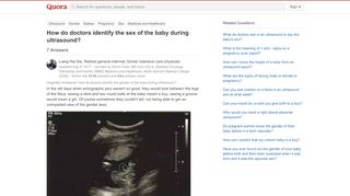 
                            12. How do doctors identify the sex of the baby during ...