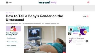 
                            2. How to Tell a Girl From a Boy on Ultrasound - Verywell Family