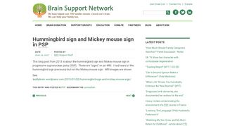 
                            5. Hummingbird sign and Mickey mouse sign in PSP - Brain Support ...