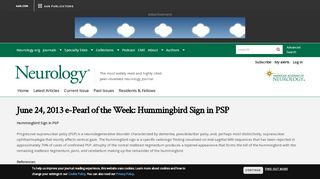 
                            8. June 24, 2013 e-Pearl of the Week: Hummingbird Sign in PSP ...