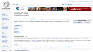 
                            5. Kussmaul's sign - Wikipedia