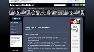 
                            7. LearningRadiology - String, Sign, Crohn, Disease, Kantor, ...