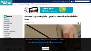 
                            11. MT-Video: Laparoskopische Operation einer Leistenhernie beim ...