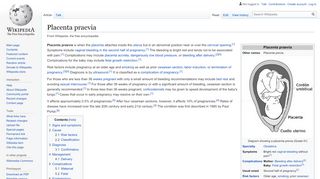 
                            4. Placenta praevia - Wikipedia