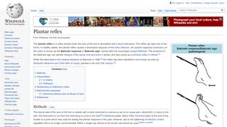 
                            12. Plantar reflex - Wikipedia