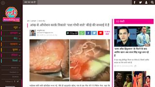 
                            11. reality of viral video that shows cabbage worm ... - लल्लन टॉप