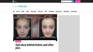 
                            12. Sad story behind before and after pics | Central Telegraph