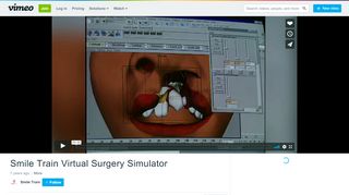 
                            13. Smile Train Virtual Surgery Simulator on Vimeo