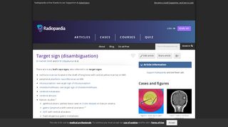 
                            6. Target sign (disambiguation) | Radiology Reference Article ...