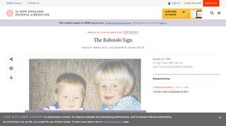 
                            5. The Babinski Sign | NEJM