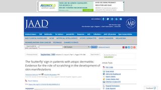 
                            4. The 'butterfly' sign in patients with atopic dermatitis: Evidence for the ...