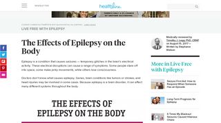 
                            8. The Effects of Epilepsy on the Body - Healthline