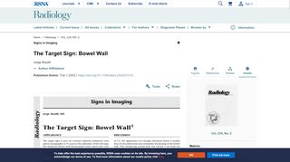 
                            7. The Target Sign: Bowel Wall | Radiology - RSNA Publications Online